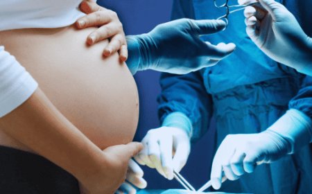 El alarmante aumento de cesáreas y sus efectos en la salud neonatal