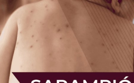 El Resurgimiento del Sarampión en México: Una Alerta Urgente