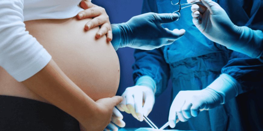 El alarmante aumento de cesáreas y sus efectos en la salud neonatal