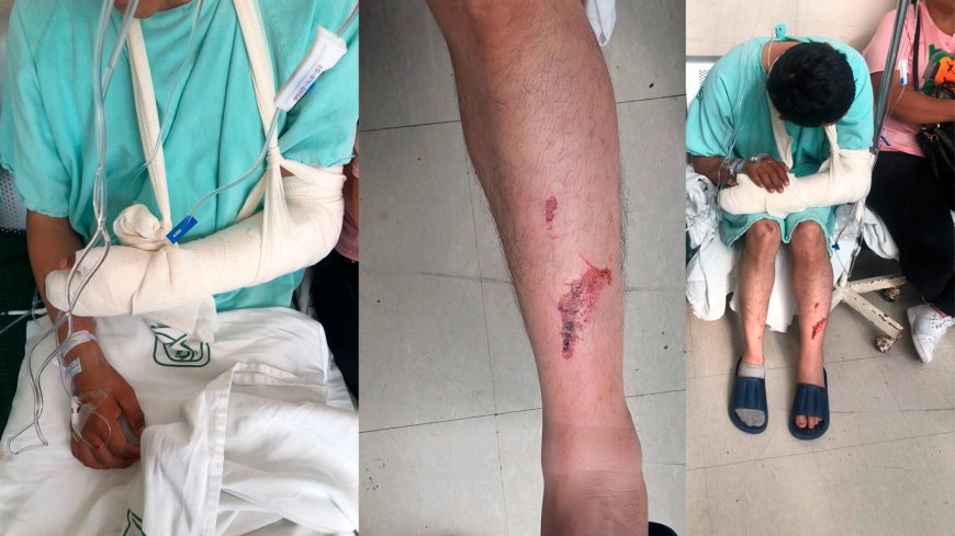 Familiares exigen responsabilidad y atención médica tras accidente con patrulla en Sayula