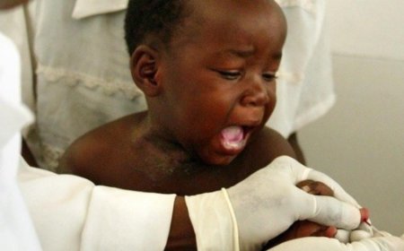 La vacuna contra la malaria: Una esperanza para reducir muertes infantiles en África