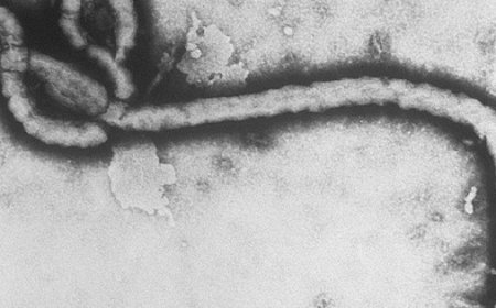 Ébola en África: Alerta sanitaria y los primeros síntomas a conocer