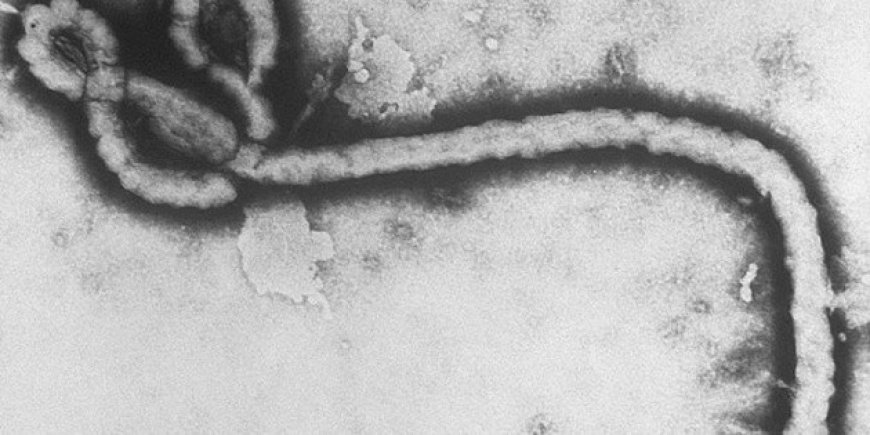 Ébola en África: Alerta sanitaria y los primeros síntomas a conocer