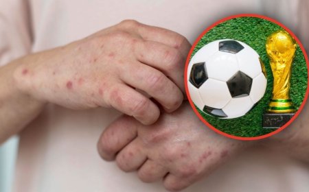 Expertos advierten que estas peligrosas ENFERMEDADES pueden propagarse durante la Copa Mundial 2026: ninguna es ébola