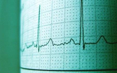 Nuevo sismo sacude de nuevo Ticul, Yucatán, tras fuerte temblor de 4.2 grados